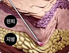 pds lvup11 build option 116993246401737446662 — 레벨업의원