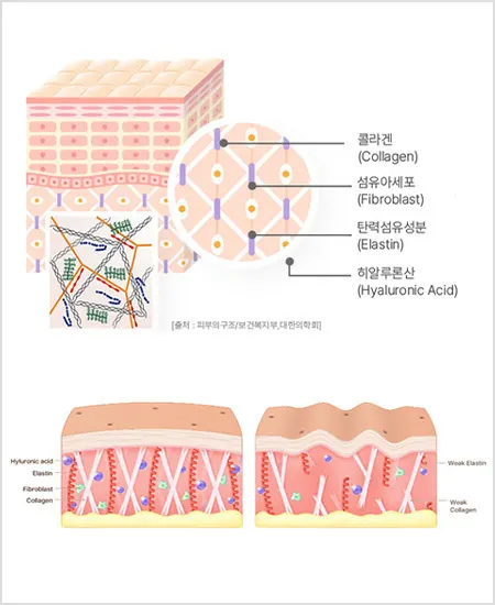 pds lvup11 build option 123451745464713 — 레벨업의원