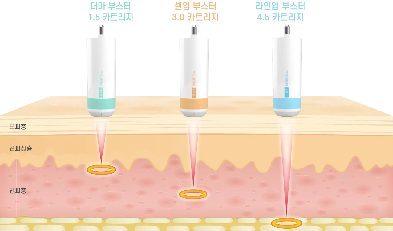 shurinku main depth 001 72d17373598051 — 레벨업의원